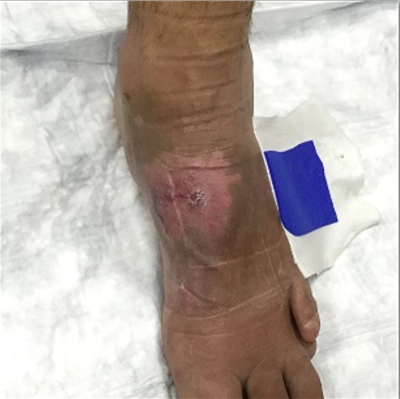 Tursivic post photo